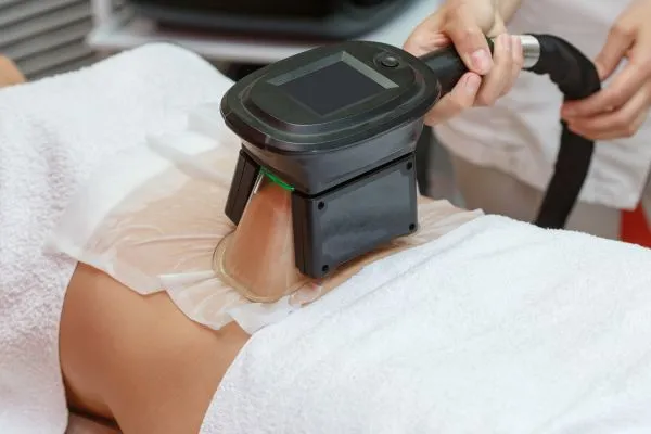 Image of person having fat freezing treatment to help weight gain Crewe