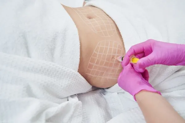 image of fat dissolving injections on love handles to help combat weight gain Crewe