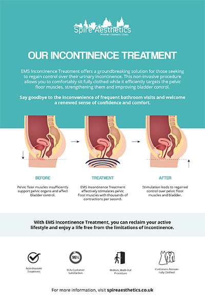 image to show how EMS treatment works for female urinary incontinence Crewe