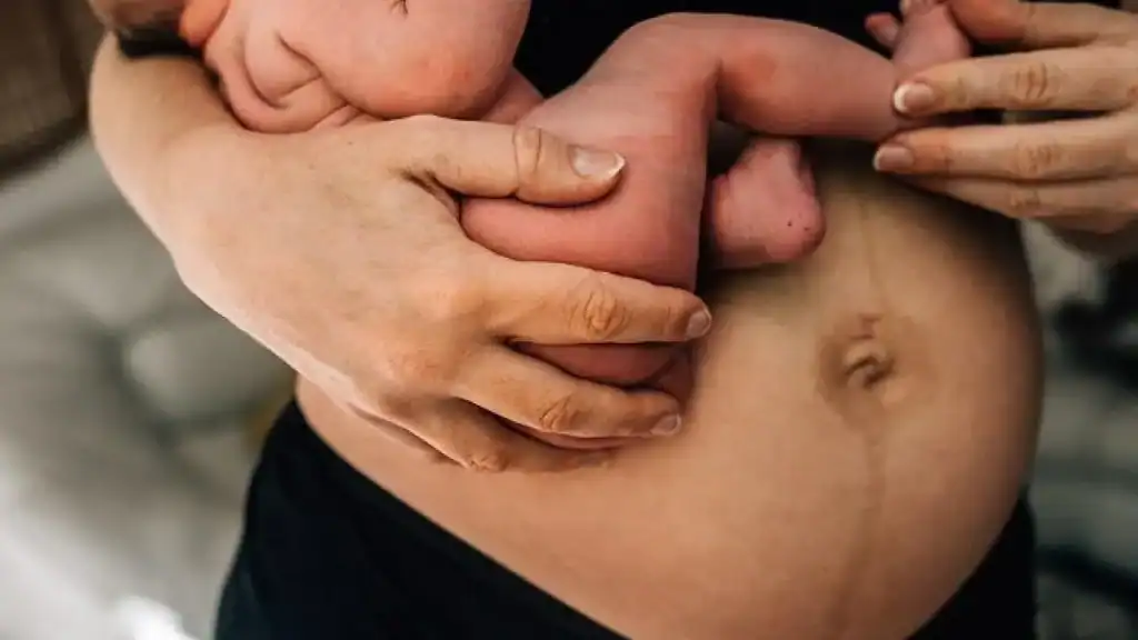 Why Is My Stomach Still Big After Pregnancy Crewe?