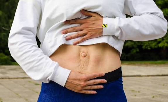 When Could Diastasis Recti Be the Missing Piece of the Puzzle Crewe?